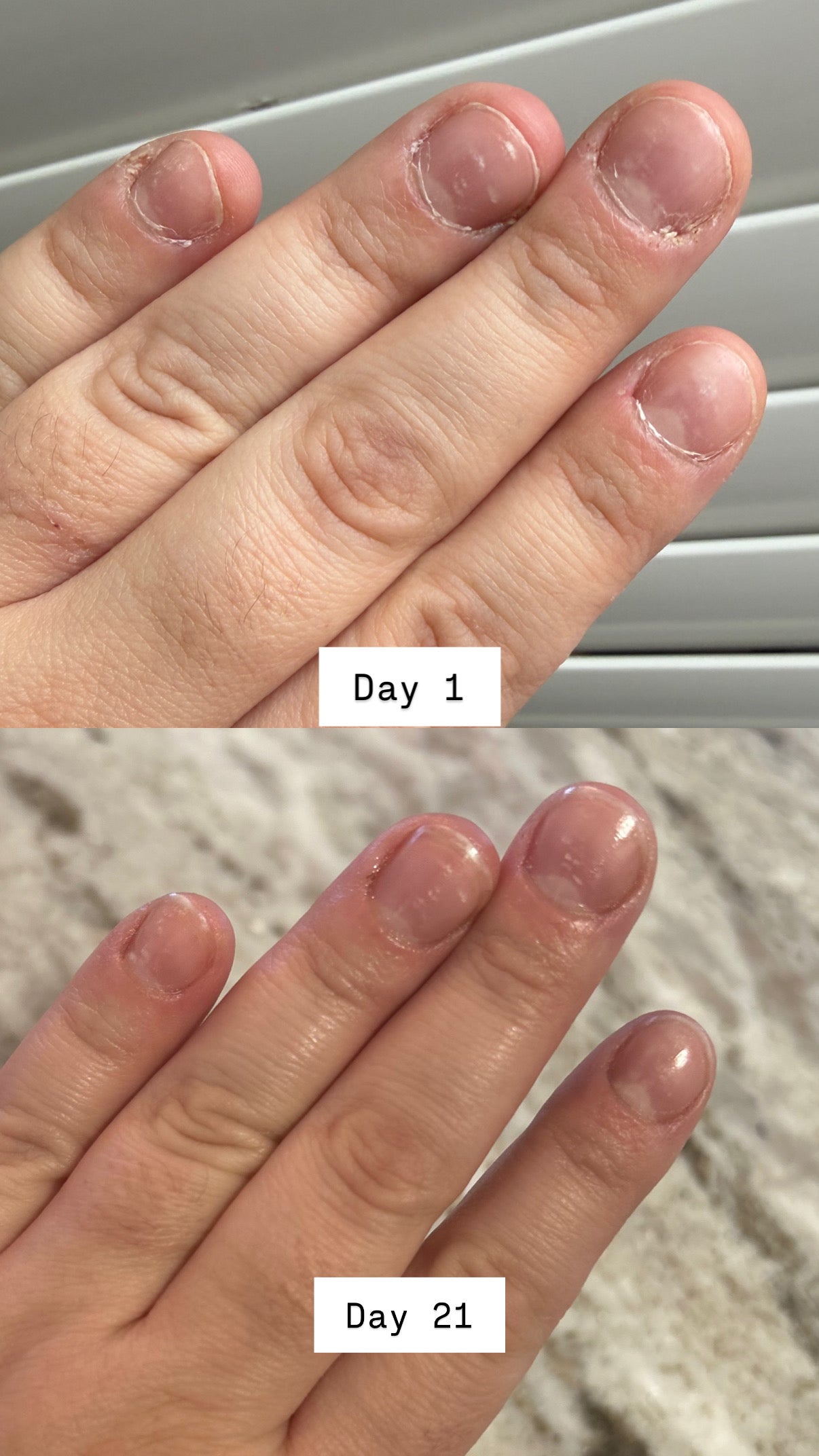 Huile Nourrissante pour Ongles et Cuticules