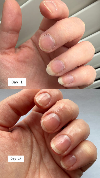 Huile Nourrissante pour Ongles et Cuticules
