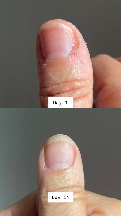 Huile Nourrissante pour Ongles et Cuticules