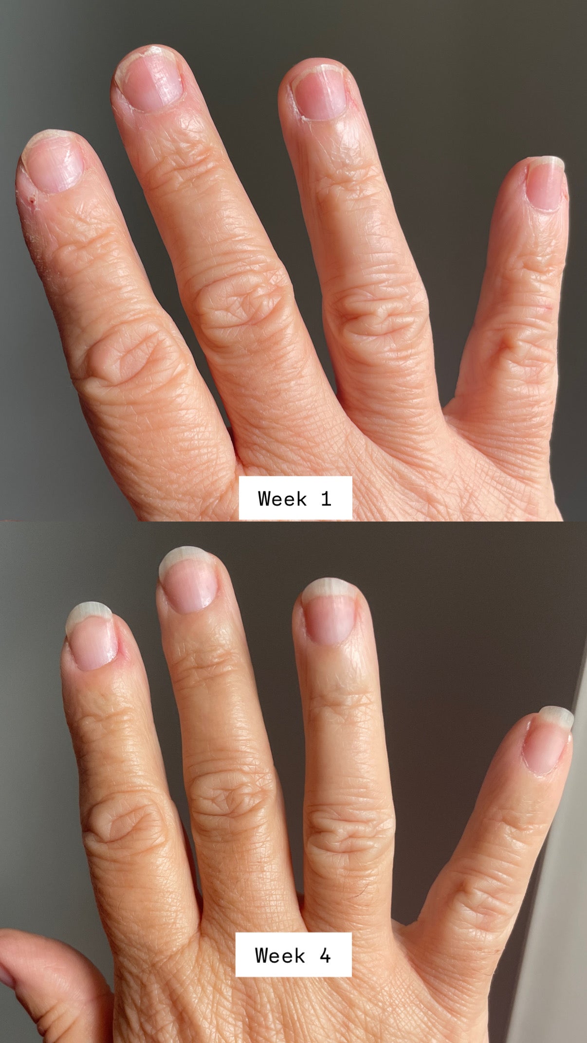 Huile Nourrissante pour Ongles et Cuticules